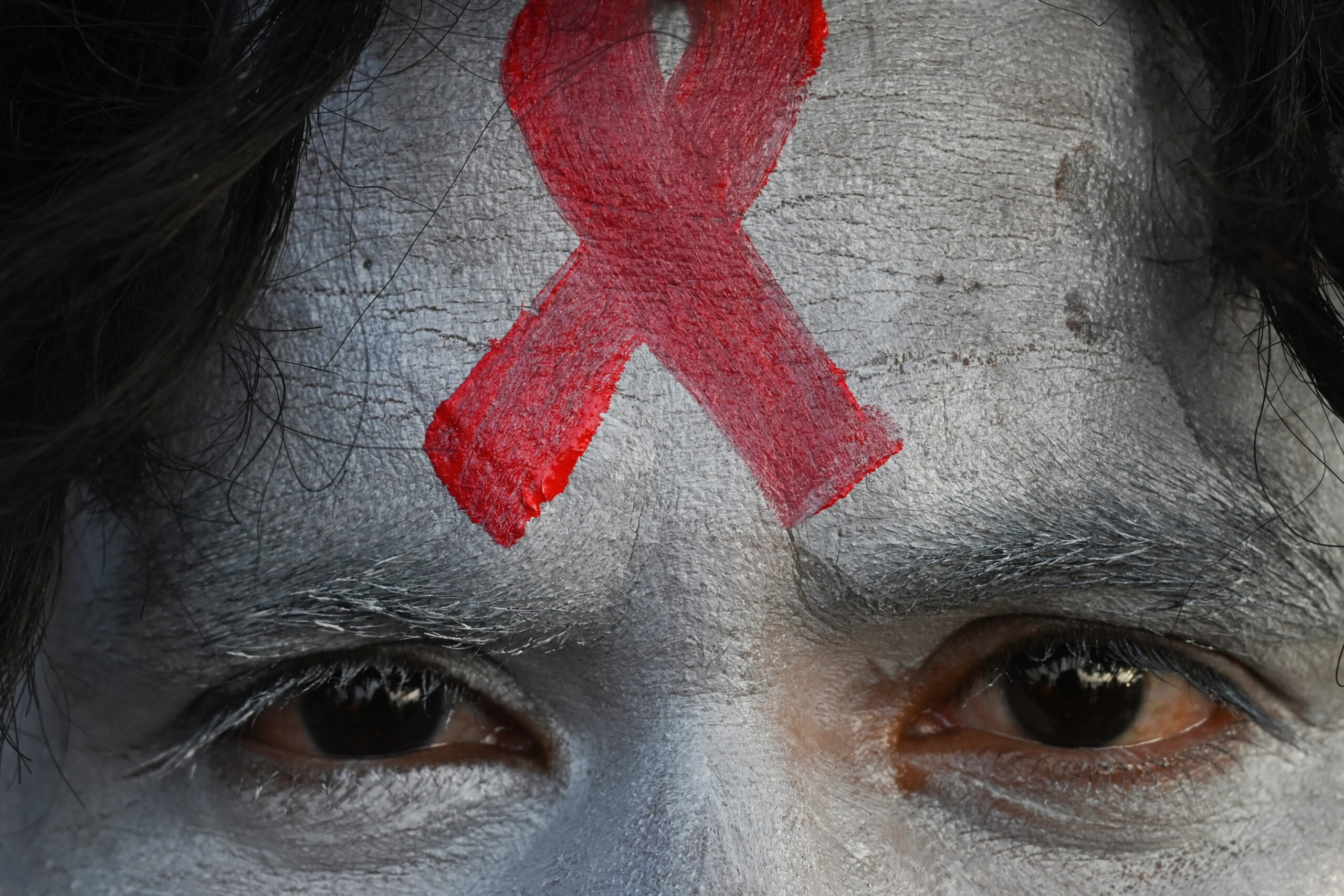 45 anos depois, Aids ainda atrai preconceito e mata milhares por ano no Brasil