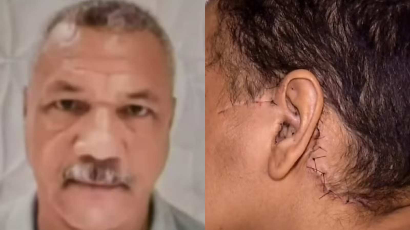 Homem que esfaqueou e decepou orelha da ex-companheira é condenado a 33 anos de prisão em Fortaleza